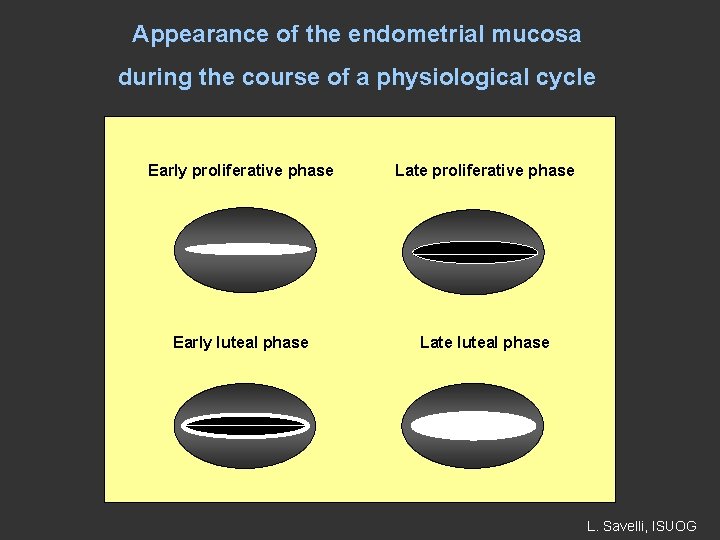 Appearance of the endometrial mucosa during the course of a physiological cycle Early proliferative