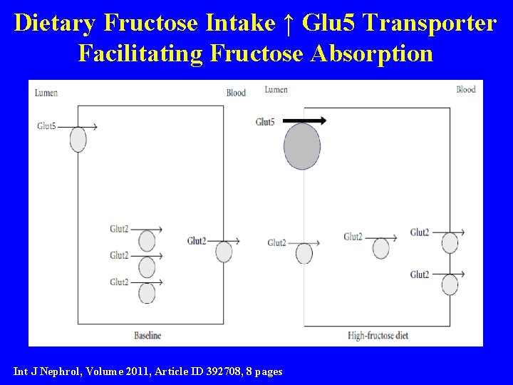 Dietary Fructose Intake ↑ Glu 5 Transporter Facilitating Fructose Absorption Int J Nephrol, Volume