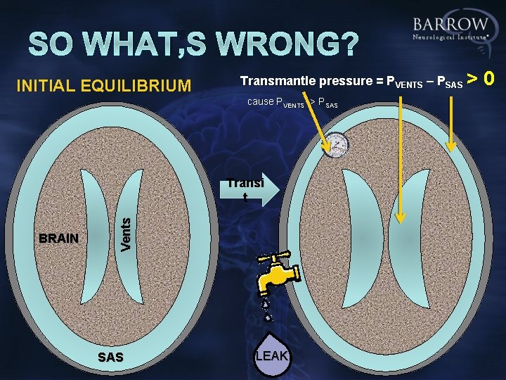 SO WHAT’S WRONG? INITIAL EQUILIBRIUM Transmantle pressure = PVENTS – PSAS > cause PVENTS