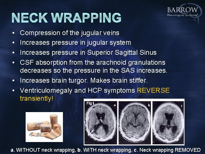 NECK WRAPPING • • Compression of the jugular veins Increases pressure in jugular system