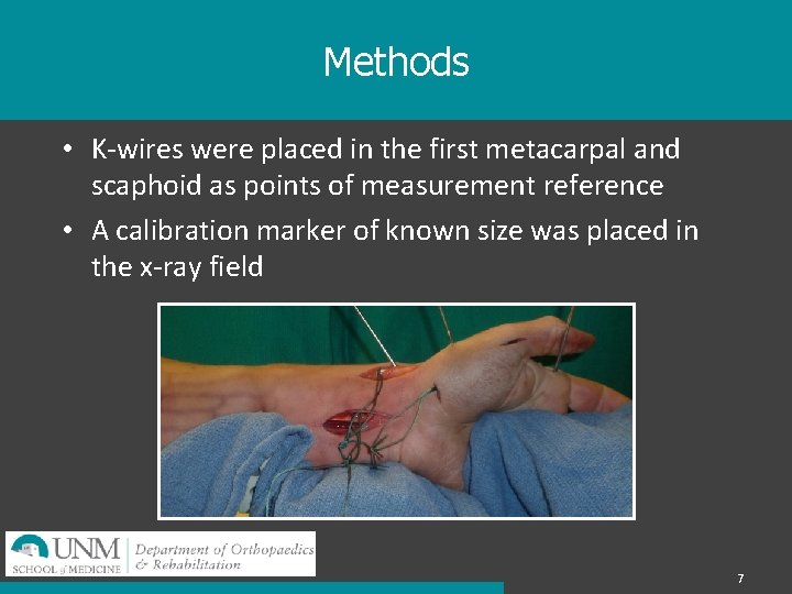 Methods • K-wires were placed in the first metacarpal and scaphoid as points of