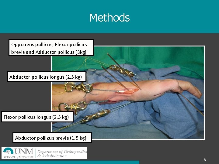 Methods Opponens pollicus, Flexor pollicus brevis and Adductor pollicus (3 kg) Abductor pollicus longus