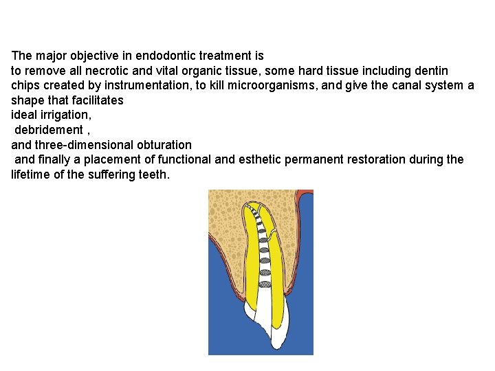 The major objective in endodontic treatment is to remove all necrotic and vital organic