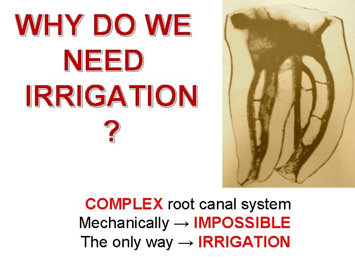 WHY DO WE NEED IRRIGATION ? COMPLEX root canal system Mechanically → IMPOSSIBLE The