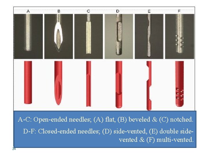 A-C: Open-ended needles; (A) flat, (B) beveled & (C) notched. D-F: Closed-ended needles; (D)