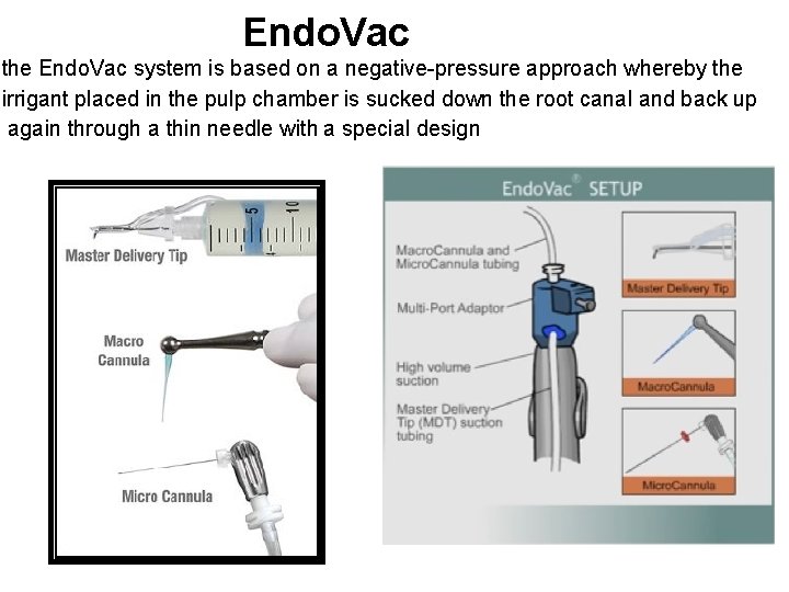 Endo. Vac the Endo. Vac system is based on a negative-pressure approach whereby the