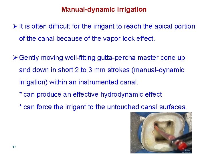 Manual-dynamic irrigation Ø It is often difficult for the irrigant to reach the apical