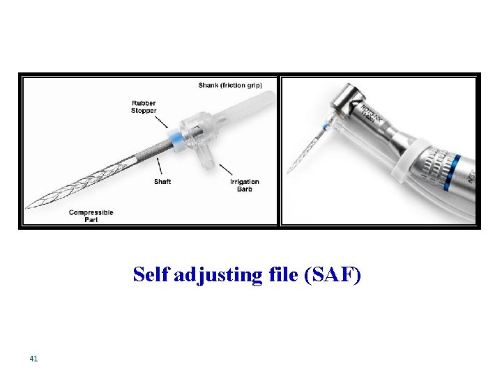 Self adjusting file (SAF) 41 