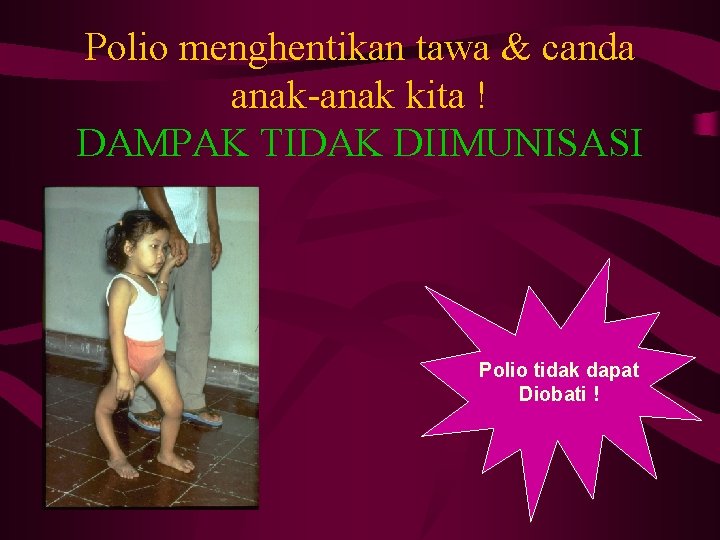 Polio menghentikan tawa & canda anak-anak kita ! DAMPAK TIDAK DIIMUNISASI Polio tidak dapat