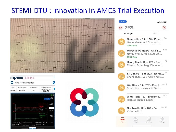 STEMI-DTU : Innovation in AMCS Trial Execution 