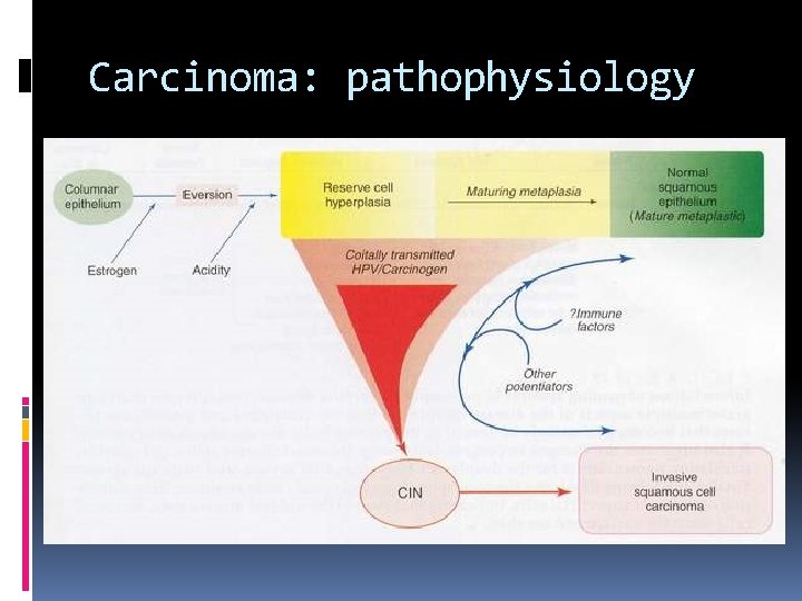 Carcinoma: pathophysiology 