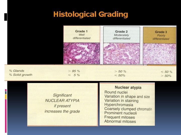 Histological Grading 