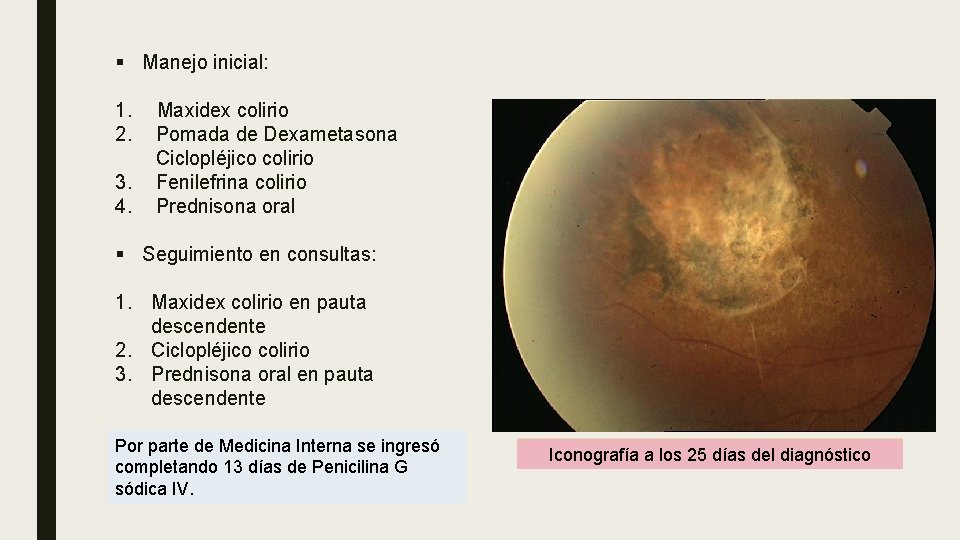 § Manejo inicial: 1. 2. 3. 4. Maxidex colirio Pomada de Dexametasona Ciclopléjico colirio § Manejo inicial: 1. 2. 3. 4. Maxidex colirio Pomada de Dexametasona Ciclopléjico colirio