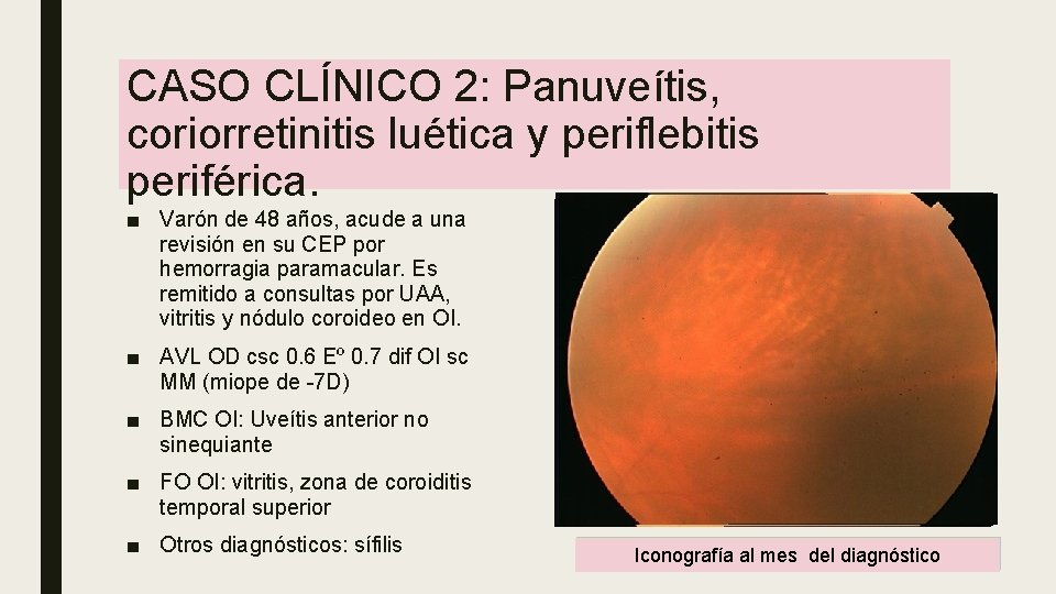 CASO CLÍNICO 2: Panuveítis, coriorretinitis luética y periflebitis periférica. ■ Varón de 48 años, CASO CLÍNICO 2: Panuveítis, coriorretinitis luética y periflebitis periférica. ■ Varón de 48 años,