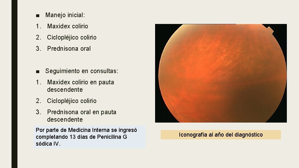 ■ Manejo inicial: 1. Maxidex colirio 2. Ciclopléjico colirio 3. Prednisona oral ■ Seguimiento ■ Manejo inicial: 1. Maxidex colirio 2. Ciclopléjico colirio 3. Prednisona oral ■ Seguimiento