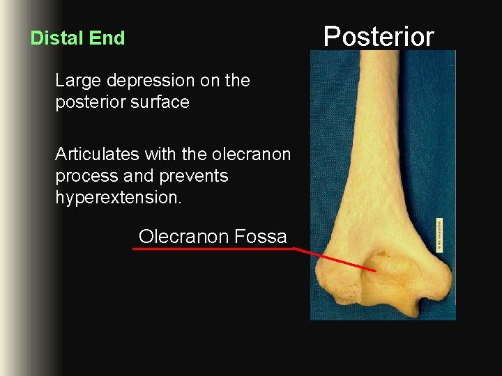 Posterior Distal End Large depression on the posterior surface Articulates with the olecranon process Posterior Distal End Large depression on the posterior surface Articulates with the olecranon process