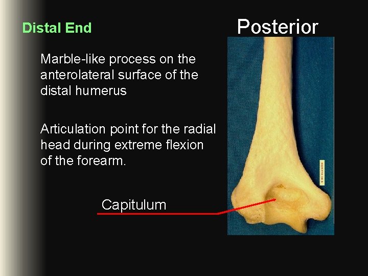 Posterior Distal End Marble-like process on the anterolateral surface of the distal humerus Articulation Posterior Distal End Marble-like process on the anterolateral surface of the distal humerus Articulation