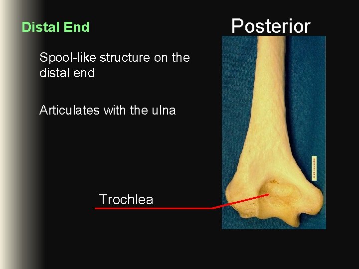 Posterior Distal End Spool-like structure on the distal end Articulates with the ulna Trochlea Posterior Distal End Spool-like structure on the distal end Articulates with the ulna Trochlea