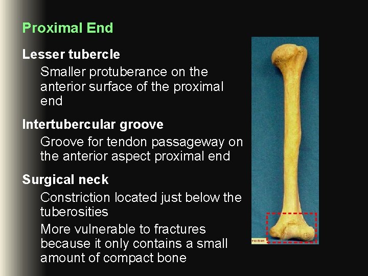 Proximal End Lesser tubercle Smaller protuberance on the anterior surface of the proximal end Proximal End Lesser tubercle Smaller protuberance on the anterior surface of the proximal end