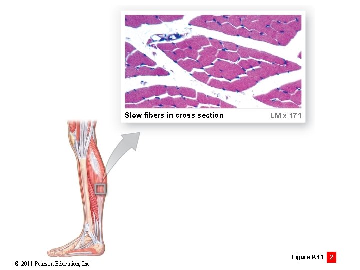 Slow fibers in cross section © 2011 Pearson Education, Inc. LM x 171 Figure