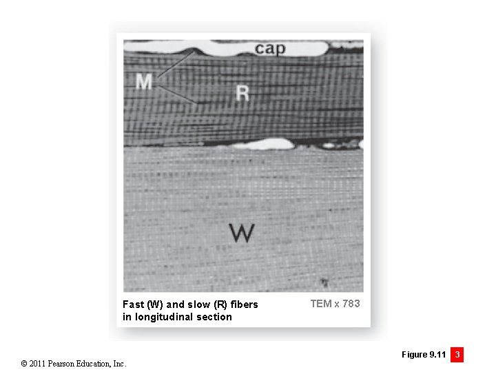 Fast (W) and slow (R) fibers in longitudinal section © 2011 Pearson Education, Inc.