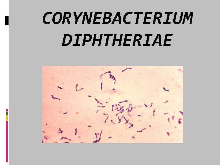 CORYNEBACTERIUM DIPHTHERIAE 