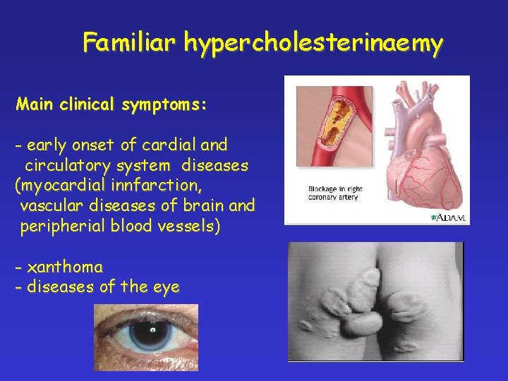 Familiar hypercholesterinaemy Main clinical symptoms: - early onset of cardial and circulatory system diseases