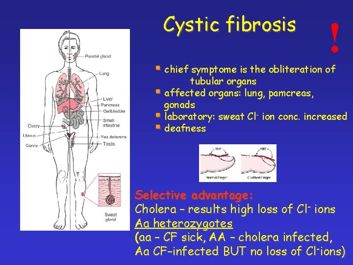 Cystic fibrosis ! § chief symptome is the obliteration of tubular organs § affected