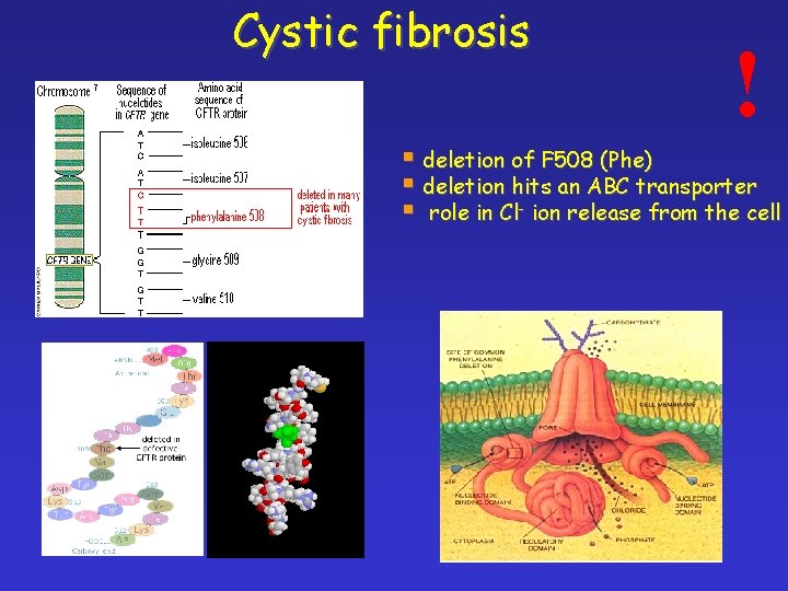 Cystic fibrosis ! § deletion of F 508 (Phe) § deletion hits an ABC