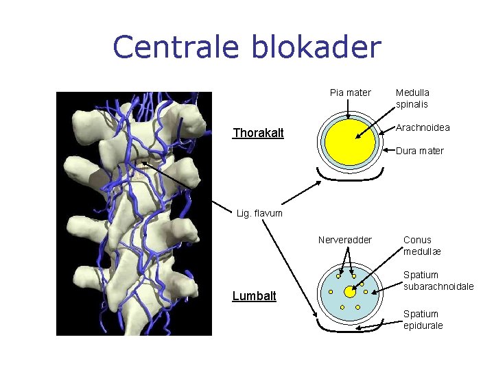 Centrale blokader Pia mater Medulla spinalis Arachnoidea Thorakalt Dura mater Lig. flavum Nerverødder Lumbalt