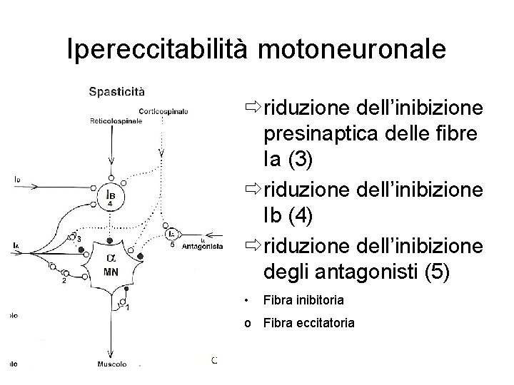 Ipereccitabilità motoneuronale ðriduzione dell’inibizione presinaptica delle fibre Ia (3) ðriduzione dell’inibizione Ib (4) ðriduzione