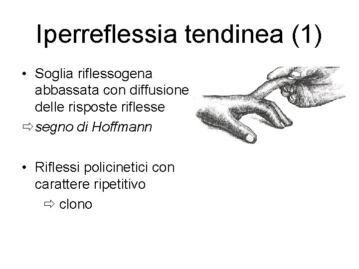 Iperreflessia tendinea (1) • Soglia riflessogena abbassata con diffusione delle risposte riflesse ð segno