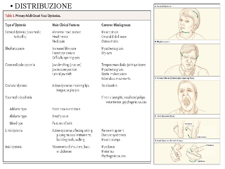  • DISTRIBUZIONE 