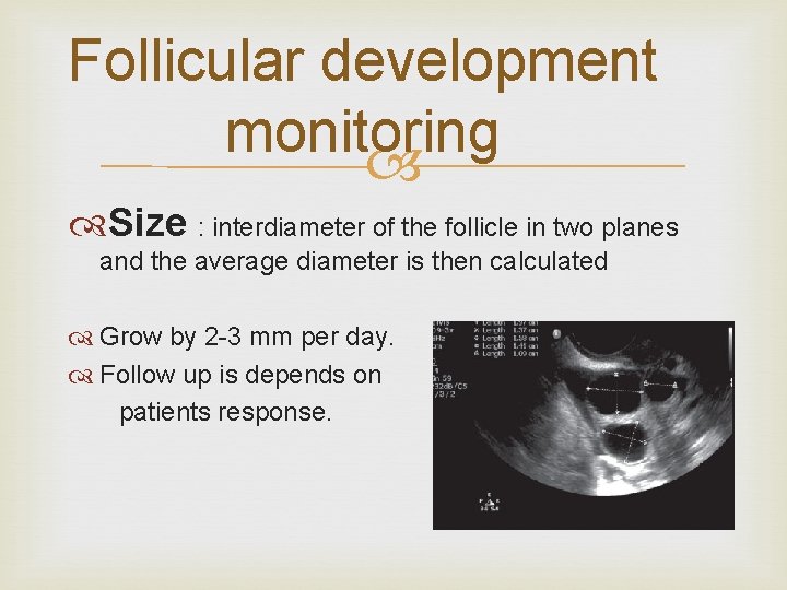 Follicular development monitoring Size : interdiameter of the follicle in two planes and the