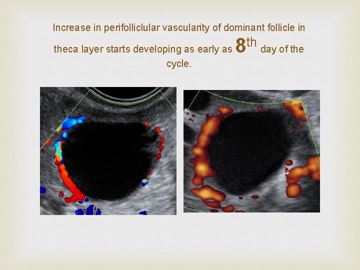Increase in perifolliclular vascularity of dominant follicle in theca layer starts developing as early
