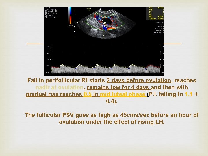  Fall in perifollicular RI starts 2 days before ovulation, reaches nadir at ovulation,