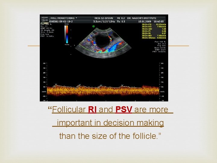  “Follicular RI and PSV are more important in decision making than the size