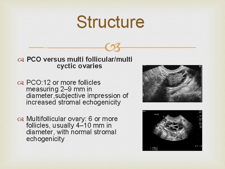 Structure PCO versus multi follicular/multi cyctic ovaries PCO: 12 or more follicles measuring 2–
