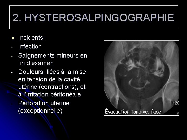 2. HYSTEROSALPINGOGRAPHIE l - - Incidents: Infection Saignements mineurs en fin d’examen Douleurs: liées