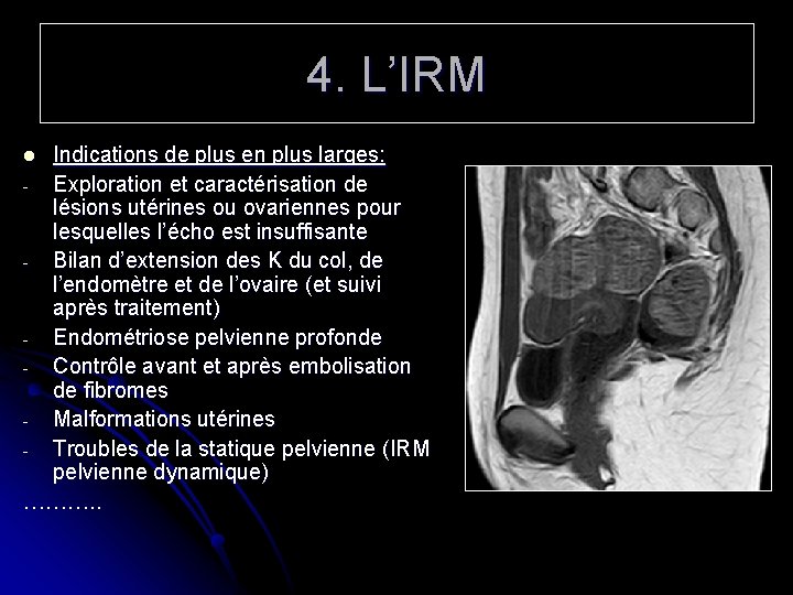 4. L’IRM Indications de plus en plus larges: - Exploration et caractérisation de lésions