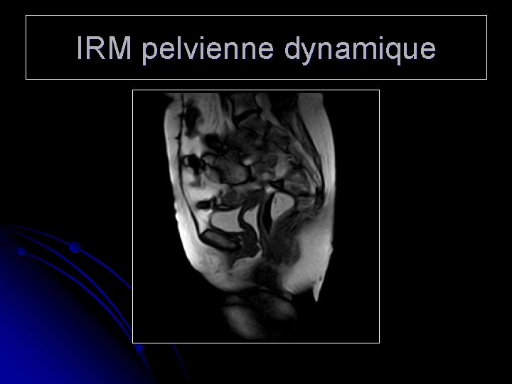 IRM pelvienne dynamique 