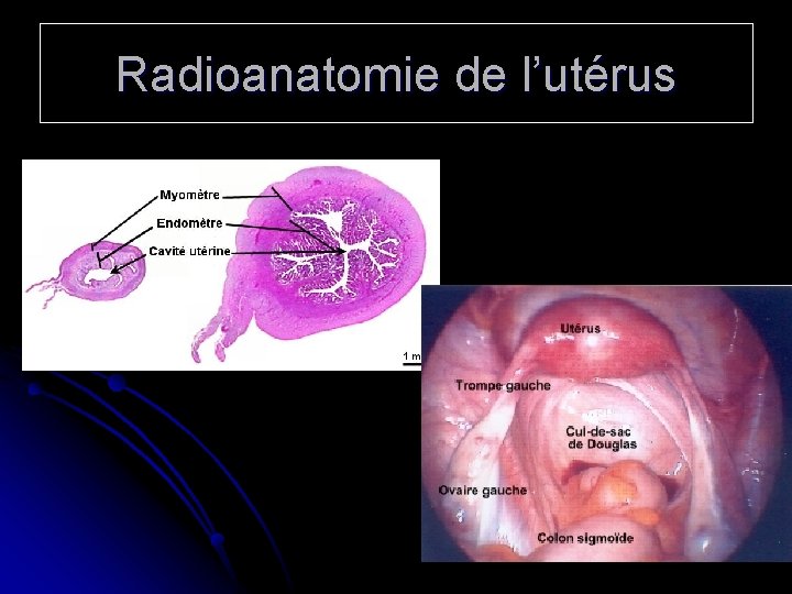 Radioanatomie de l’utérus 
