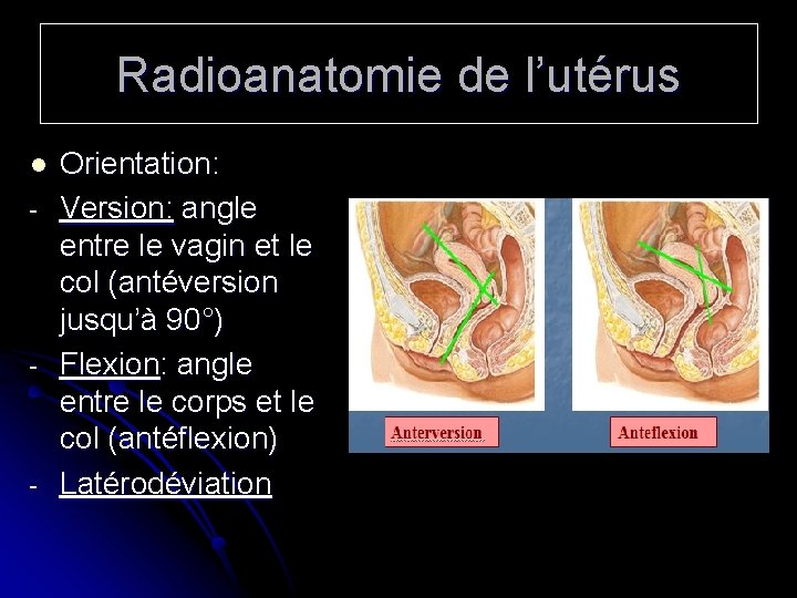 Radioanatomie de l’utérus l - - - Orientation: Version: angle entre le vagin et