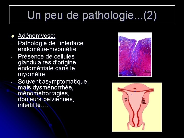 Un peu de pathologie. . . (2) l - - Adénomyose: Pathologie de l’interface