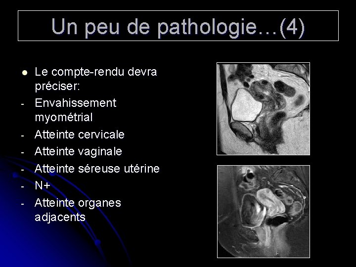 Un peu de pathologie…(4) l - Le compte-rendu devra préciser: Envahissement myométrial Atteinte cervicale
