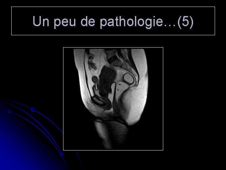 Un peu de pathologie…(5) 
