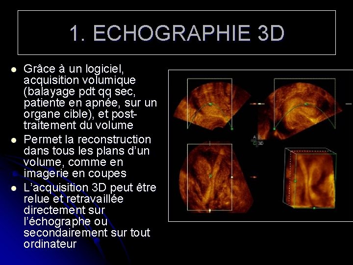 1. ECHOGRAPHIE 3 D l l l Grâce à un logiciel, acquisition volumique (balayage