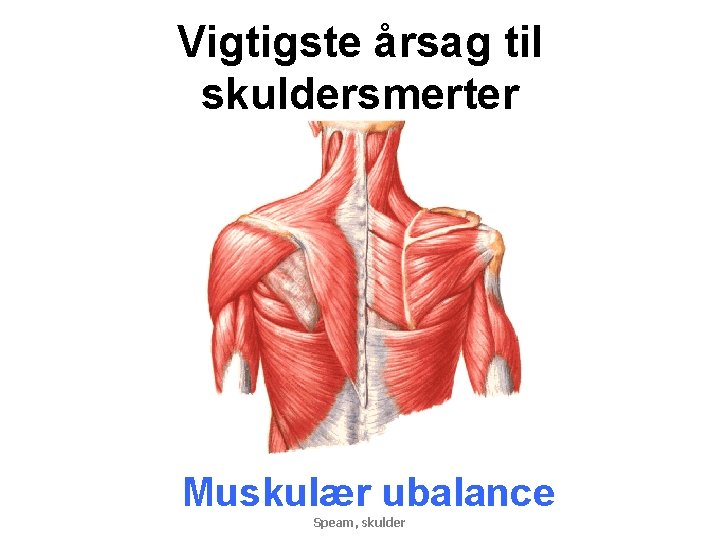 Vigtigste årsag til skuldersmerter Muskulær ubalance Speam, skulder 