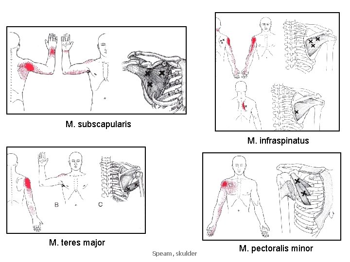 M. subscapularis M. infraspinatus M. teres major Speam, skulder M. pectoralis minor 