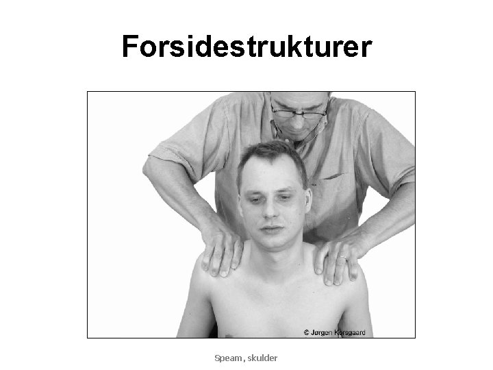 Forsidestrukturer Speam, skulder 